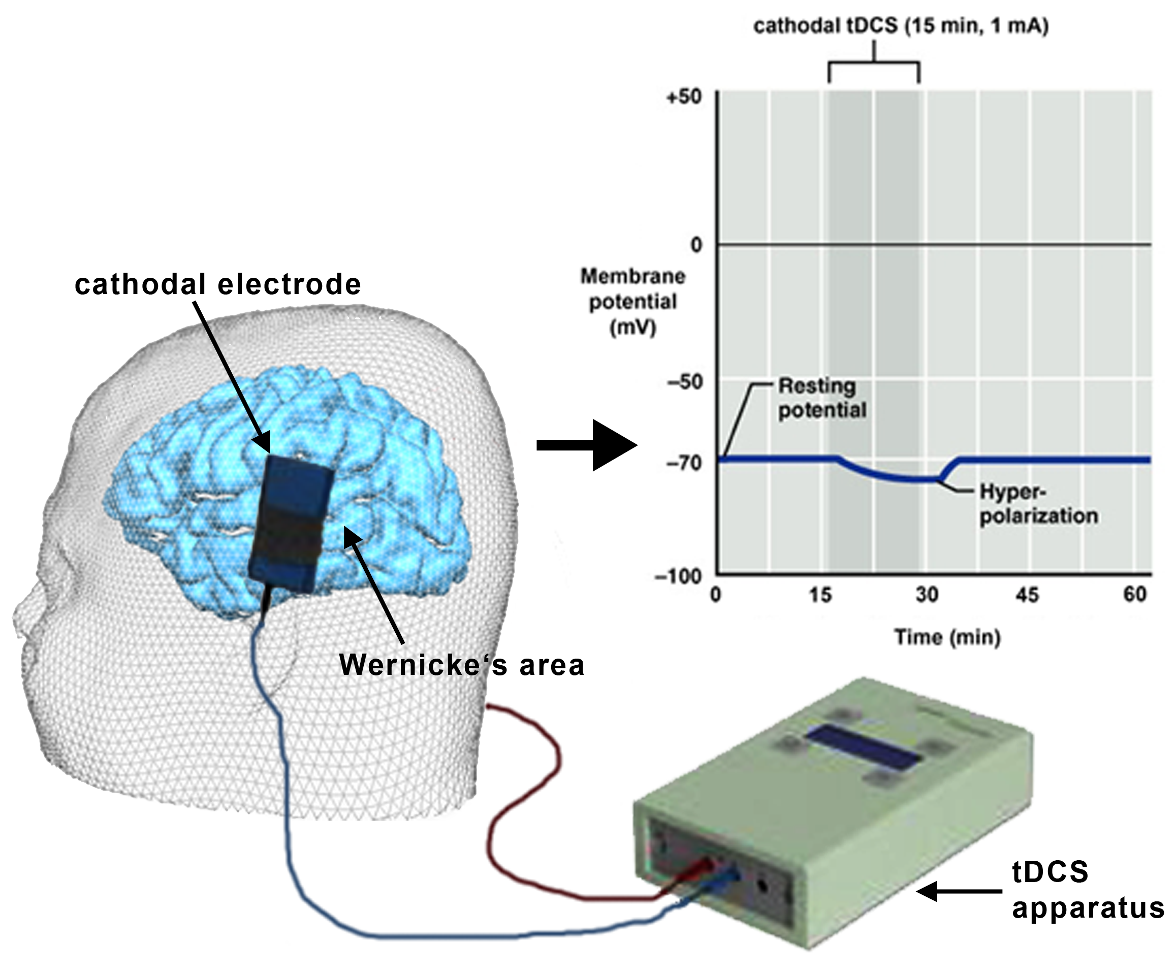 Cathodal (negative) transcranial direct current stimulation (tDCS) supposedly causes hyperpolarization at Wernicke's area.