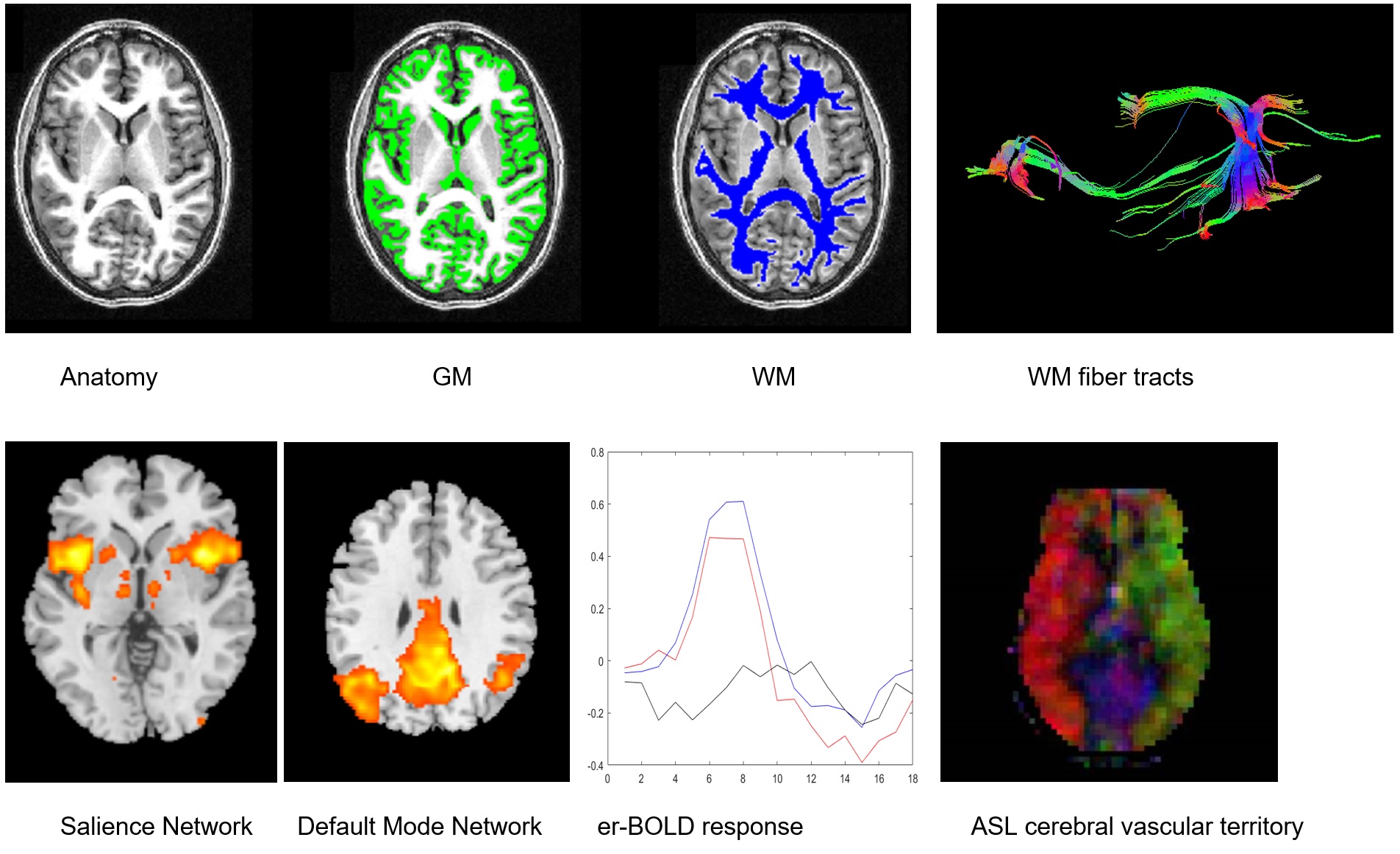 sample mri pictures